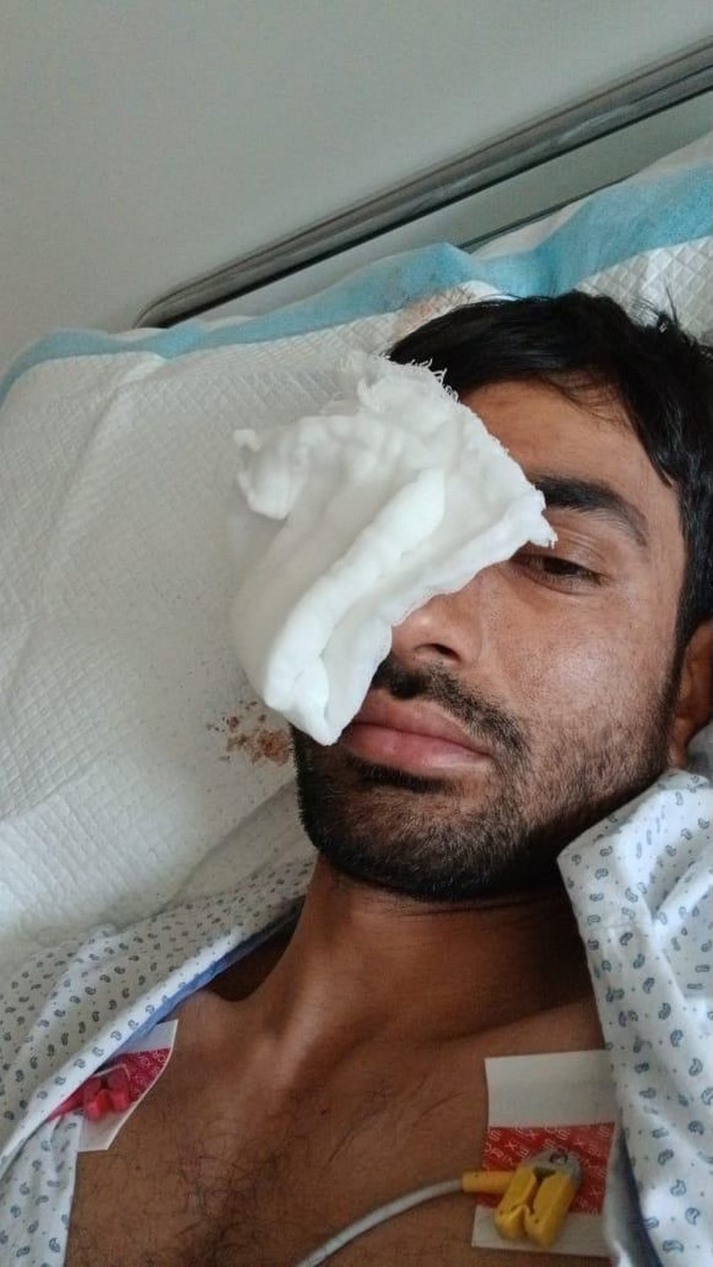 Афганский беженец в больнице в Беларуси. Фото: Wesal TV